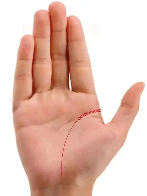 神奇望诊之生命线起点有锁链状