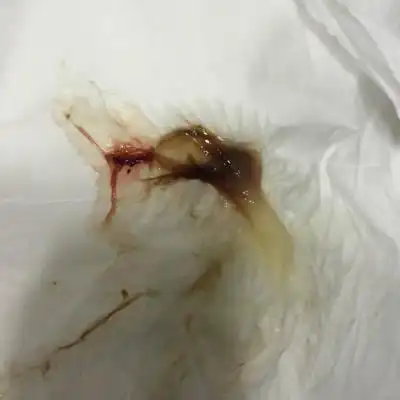 请问大家这是见红吗?