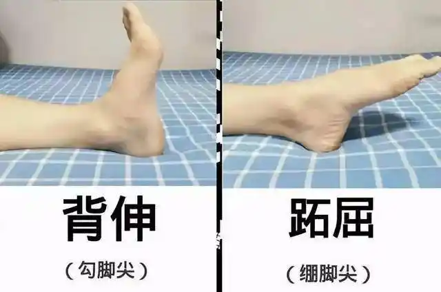 卧床休息时,两腿并拢伸直,将脚尖一勾一放,可两脚一起做,也可进行单脚