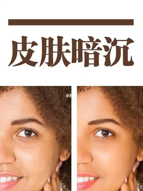 你可能不是皮肤黑,只是皮肤暗沉,我们肤色的暗沉不均匀影响了整个人的