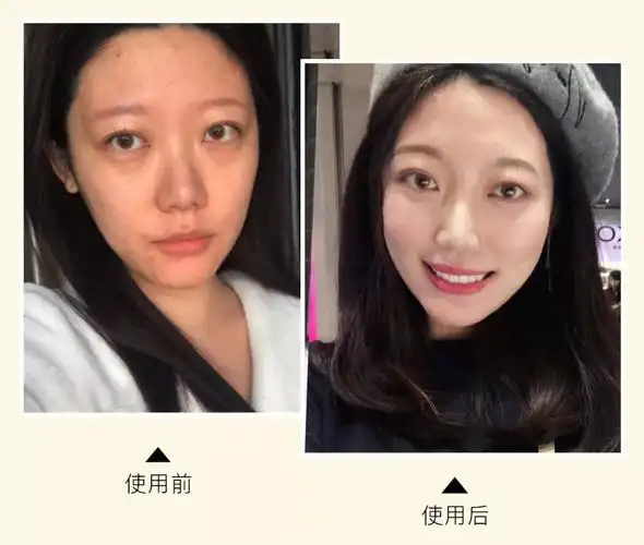 拥有一张白净无暇的脸,向来是我最想实现的愿望.