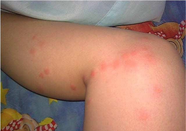 卧室中的它成了螨虫滋生的温床教你几招不用晒太阳轻松除螨法