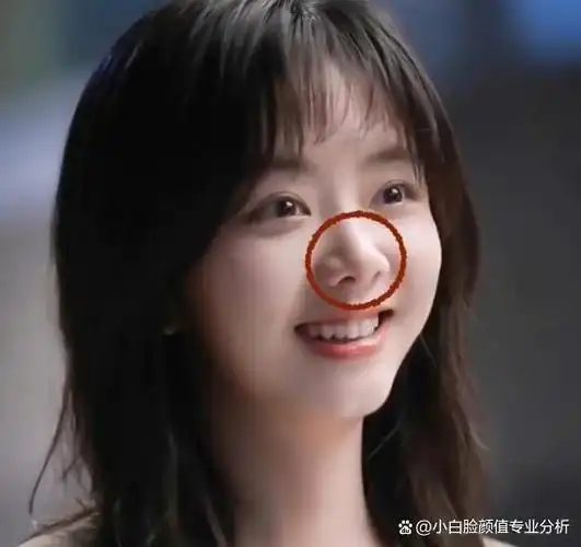 整形医生:幼态脸天花板谭松韵,为何不够精致的鼻子反而加分