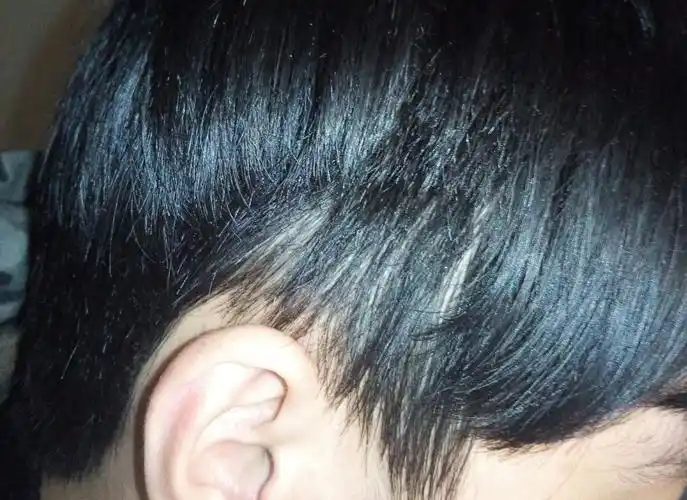 3个月以前 这一撮头发长不长.