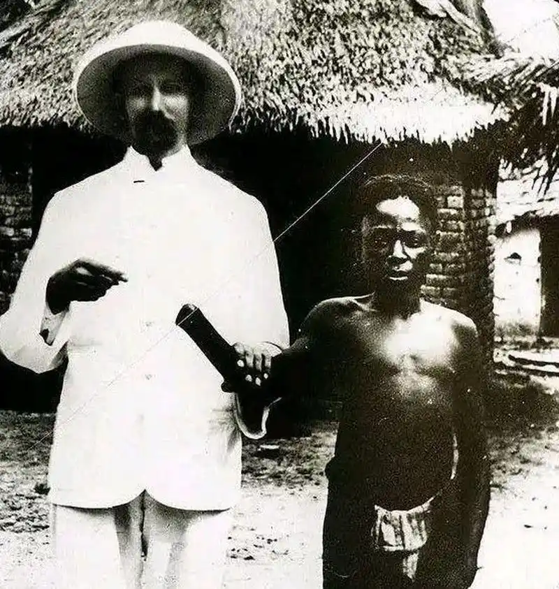 1908年,非洲刚果,两名被比利时人砍掉双手的黑人少年.