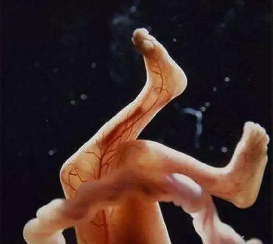 六个月可以打掉吗,怀孕六个月打胎