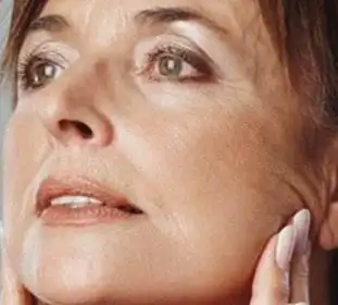 脸部肌肉开始松弛下垂有哪些医疗美容方式可以提拉脸部