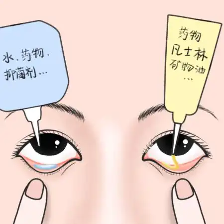 眼膏正确使用方法:扒开下眼睑,眼膏