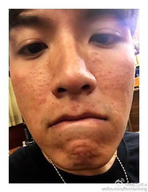 主题:1991年出生的已经是这张脸啦,娱乐圈真是可怕