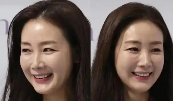 要说的是为什么会有这么多的漂亮妹子医美填充好看,就像王子文,奚梦瑶