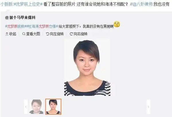 网曝沈梦辰疑似整容 出道10年容貌变化大