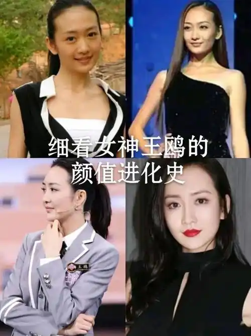 王鸥早年下颚骨突出下巴较短后来打了瘦脸针和填充下巴