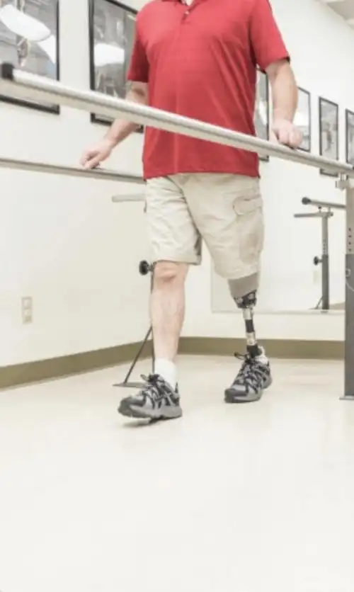 新截肢患者常问的一些问题_假肢