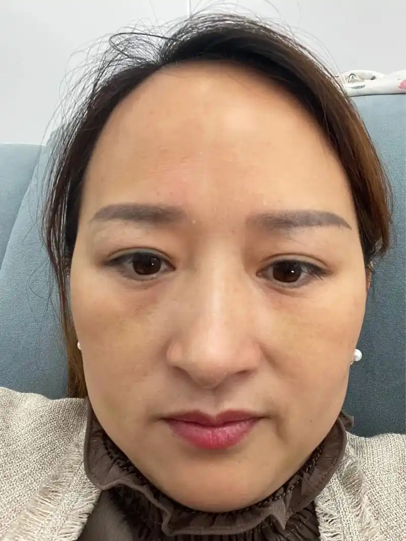 祛黄22天皮肤又白又亮打造素颜美