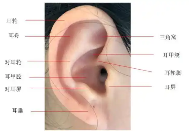 陈方无创耳廓畸形矫形新生儿耳畸形的福音丨科普篇