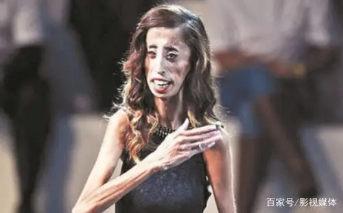 世界上最瘦的女人,身高1.57米,全身上下皮包骨