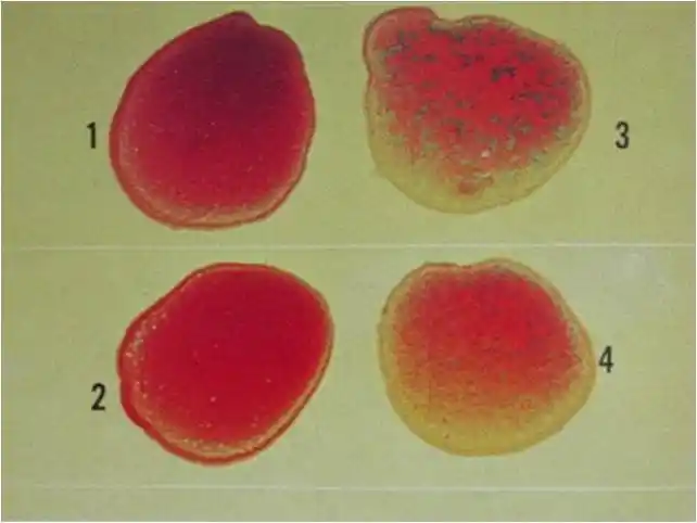 全血平板凝集试验结果
