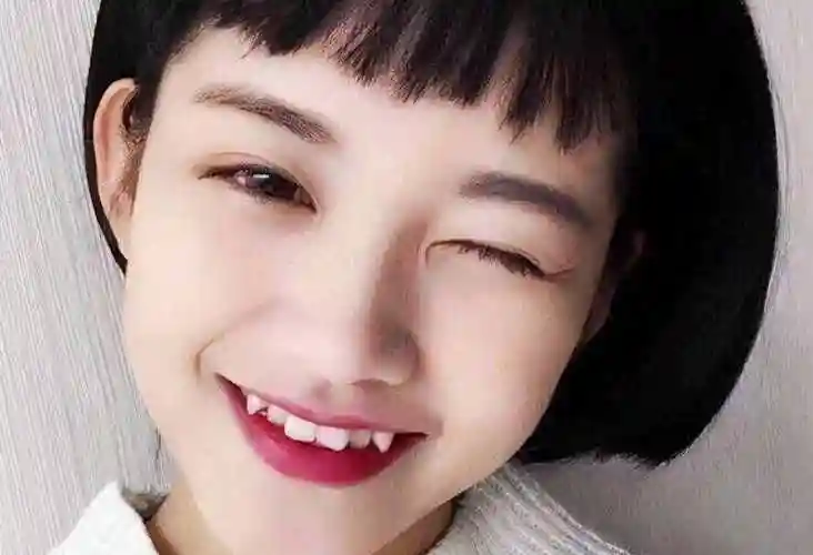 虎牙是什么虎牙是病吗