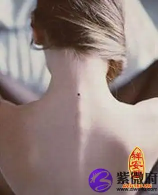 后背有痣代表你很有远大的理想很美好的憧憬,但是苦无门路和机遇,你的