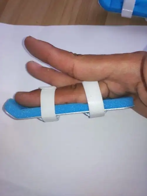 弯曲式手指骨折固定带铝合金指骨夹板指托上翘护指套支具透气舒适