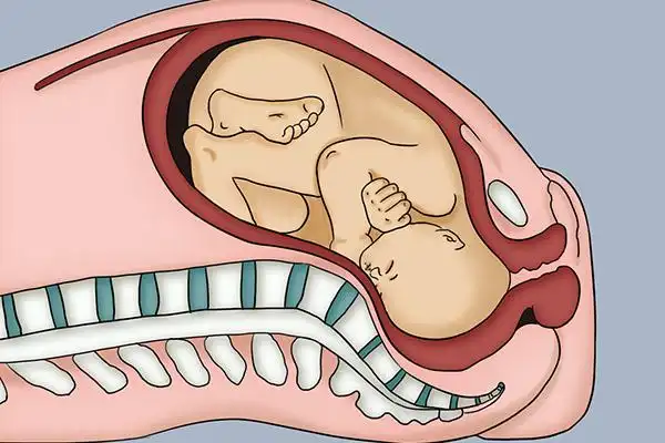 看清楚二胎全入盆和半入盆图片,感觉和肚型是主要区别