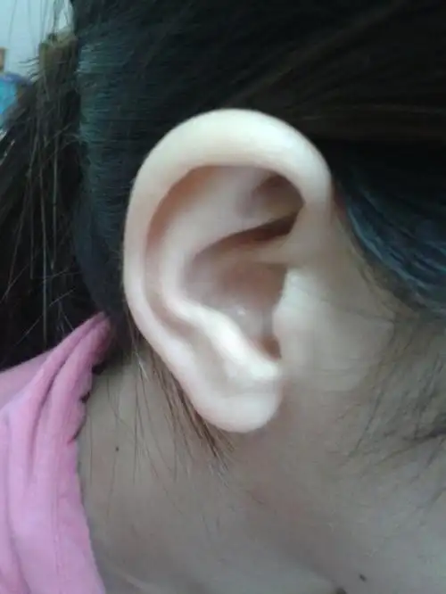 左耳朵有两个痣,会看相的请进.