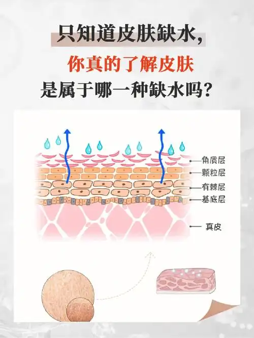 你真的了解皮肤是属于哪一种缺水吗