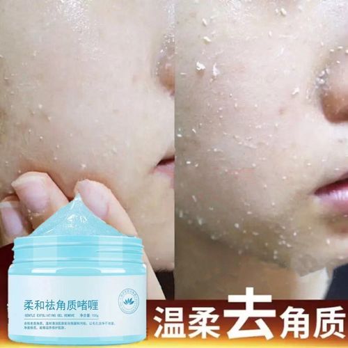 泊泉雅去脸上死皮的去角质层去死皮祛面部角质深层清洁除收缩毛孔男士