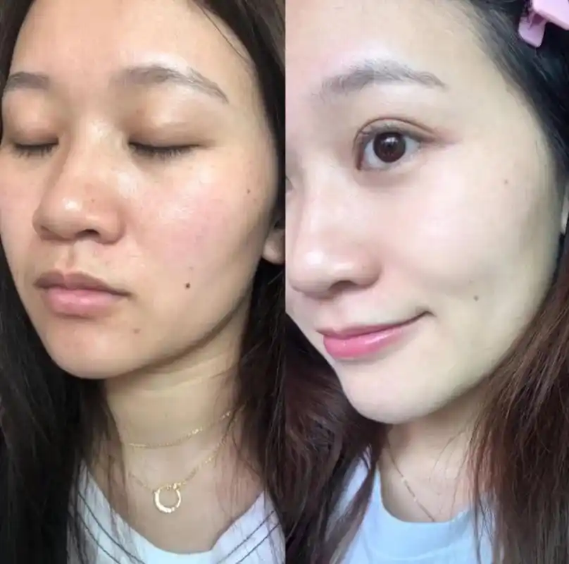 面对肌肤问题,我们可以选择那几种医美方法来改善呢?