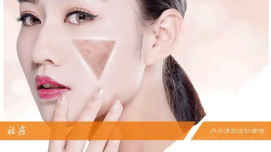 丹丹专业祛痘护理中心