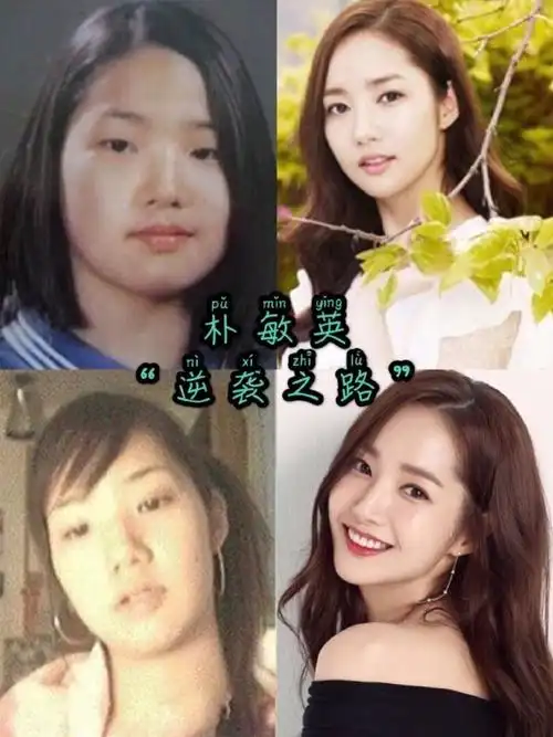 韩国娱乐圈,谁没整容过?