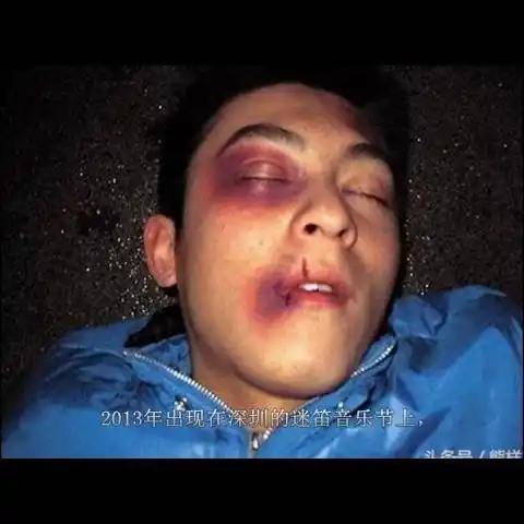 陈冠希曾被暗杀殴打"很多人觉得我前几年已经死了,我还活着!