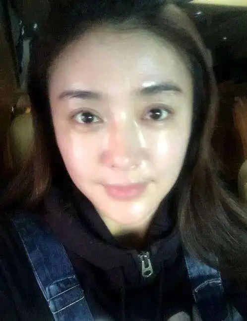 打脸娱乐圈|秦岚|皇后|痘痘_新浪新闻