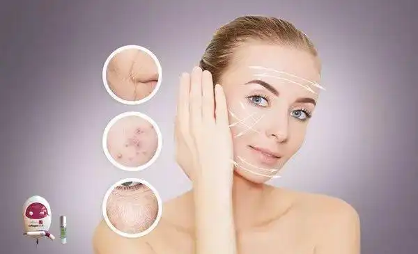 无针胶原逆龄时光系列:无创无痛,一项护理解决所有肌肤问题