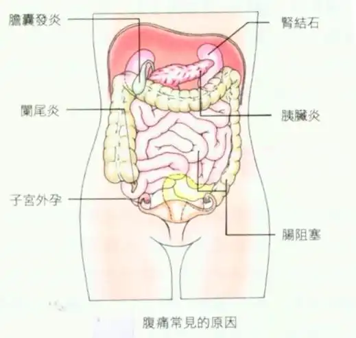 喷门炎能输液嘛