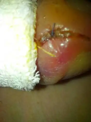 但系带实在看不出来.请医生看看