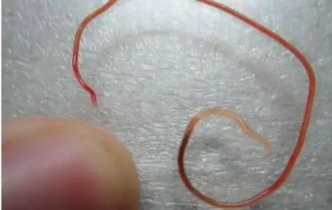 三岁小孩肚子痛送医,医生的检查结果