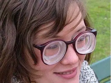 对于近视眼的患者来讲,600度的近视就已经属于是高度近视范围之内