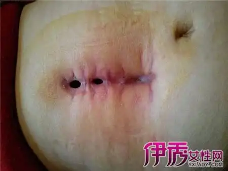 5个处理方法帮助你