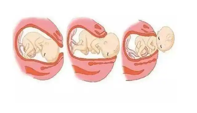 胎儿一般什么时候入盆,入盆是什么感觉?看看育儿专家理解