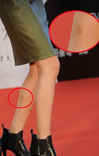 杨幂——小腿现神秘胎记