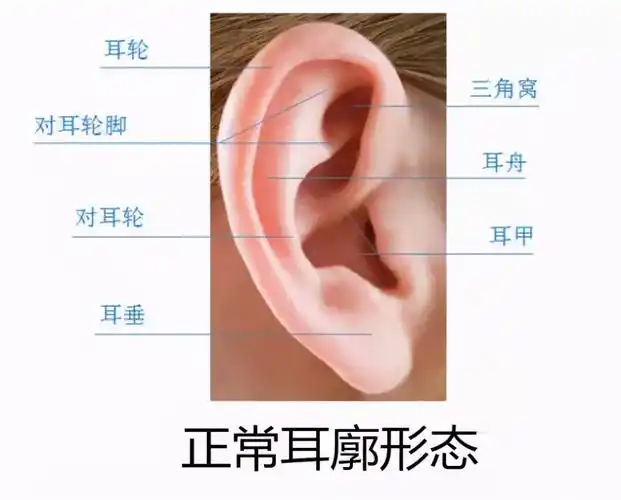 新生儿耳廓畸形宝爸宝妈们常常忽视而错过了最佳治疗时间