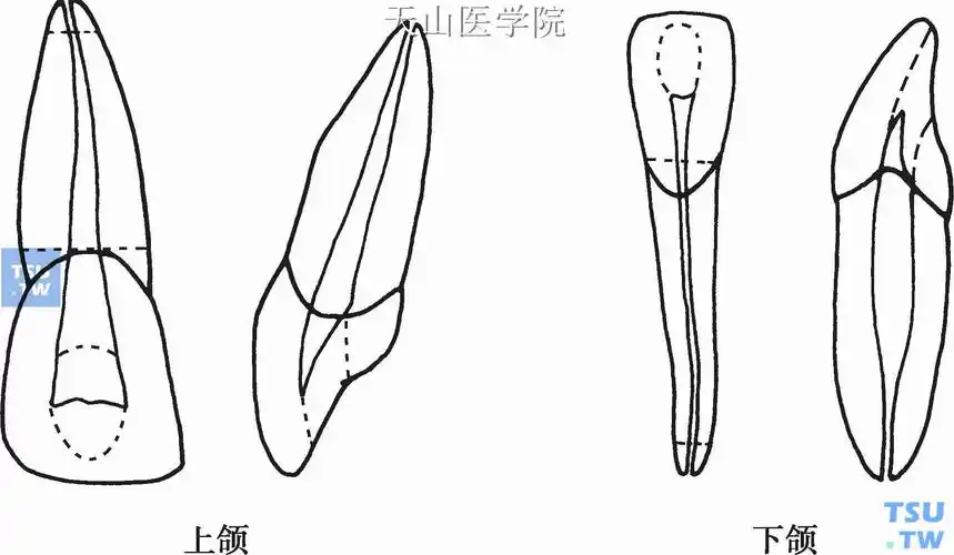 通常其根管较粗大,上颌中切牙根管在牙颈部类似三角形,向根尖孔方向