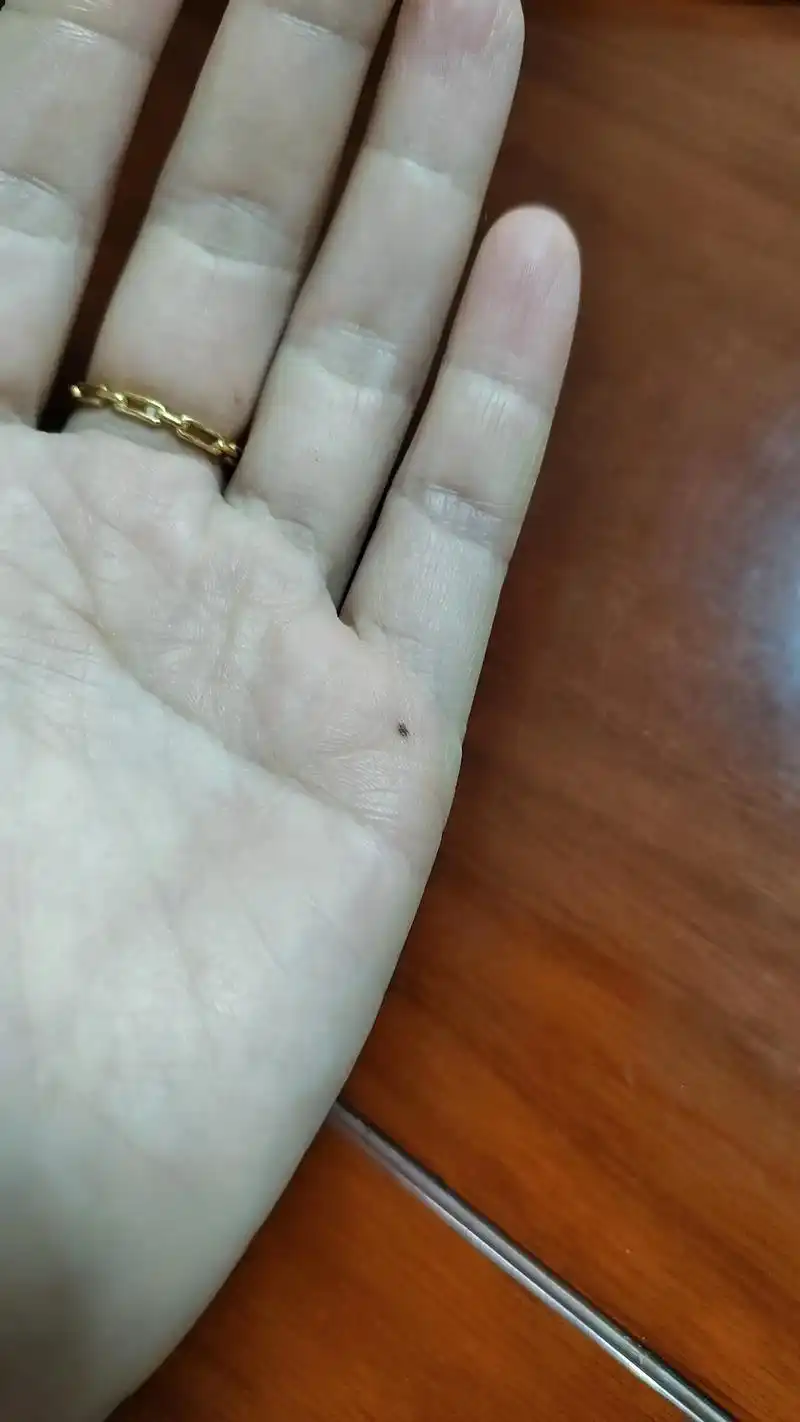 人说左手痣时来运转左手突然长痣痕迹痣出代表在爱里被辜负痣出上辈子