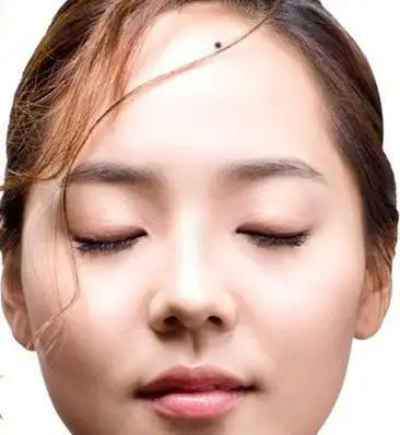 女生面部痣相图解