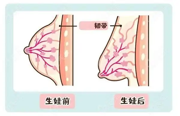 胸下垂的根本原因