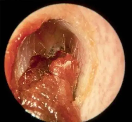 陈老师收集各种耳朵图片