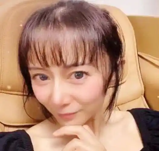 原创塞娅公主张恒近照曝光模样大变发量告危太秃然