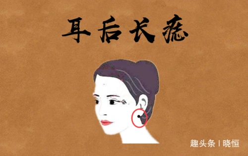 耳后长痣在耳朵的后边的方位处长有吉痣,被称之为暗财痣,多半具有这样