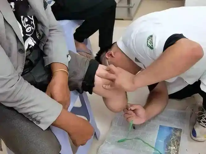 技术人员询问每一位残疾人的截肢原因,适配需求,查看他们的残肢部位